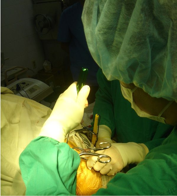 회전근개파열수술